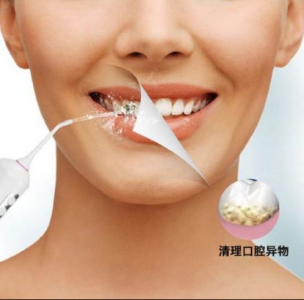 口腔清潔好幫手，美國XNUO心諾沖牙器值得信賴