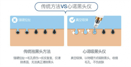 雙11最值得入手的面部清潔電器！美國心諾黑頭儀價格直降一半！