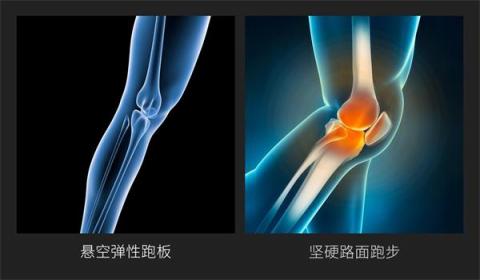 小米眾籌首款智能折疊跑步機來襲，讓愛跑步的人有“地”放矢