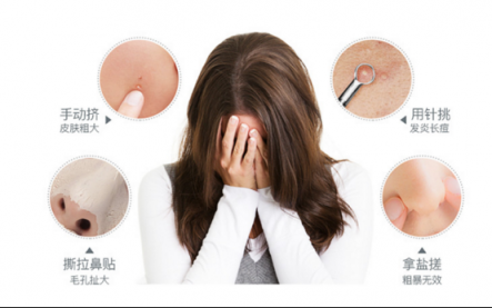 正確的清除黑頭方法來(lái)啦！黑頭儀有用嗎？