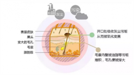 讓你的黑頭全退散！黑頭儀有用嗎？