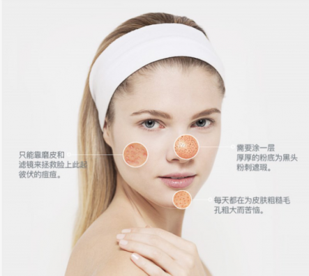一百種去黑頭的方法都失敗了？去黑頭攻略全部拿下！