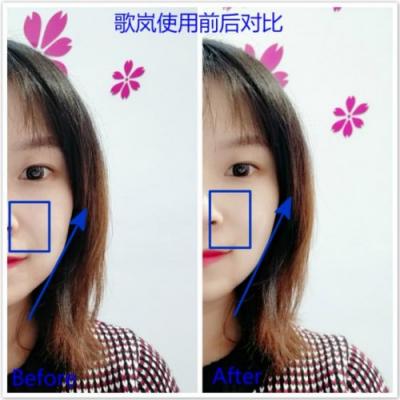 雅萌、GEVILAN歌嵐、Tripollar、NEWA美容儀到底選哪個(gè)？先評測一下再說