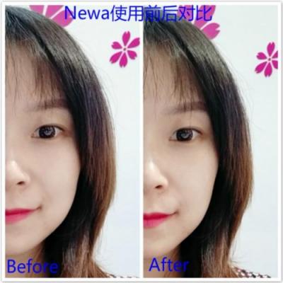 雅萌、GEVILAN歌嵐、Tripollar、NEWA美容儀到底選哪個(gè)？先評測一下再說
