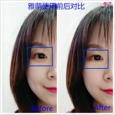 雅萌、GEVILAN歌嵐、Tripollar、NEWA美容儀到底選哪個(gè)？先評測一下再說