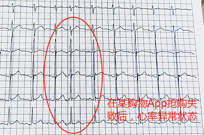 618網(wǎng)購(gòu)致老人多次心率異常 ?醫(yī)生提示要選有保障的網(wǎng)購(gòu)平臺(tái)