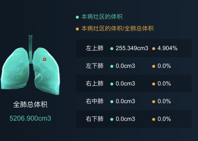 平安科技入選工信部抗疫表現(xiàn)突出企業(yè) 新冠肺炎AI閱片助力重點疫區(qū)