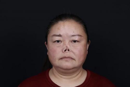 她，被羞辱欺凌40年，2020年成為新氧公益救助第一人