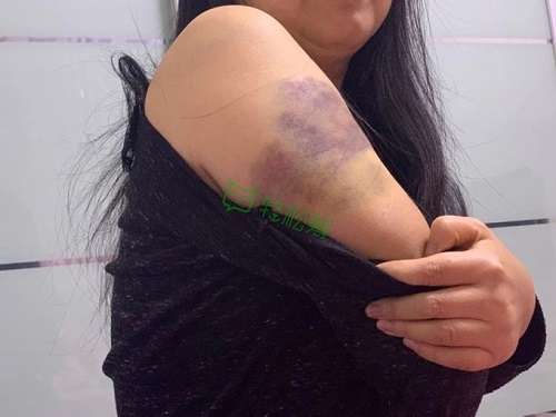 “我想有生之年看到女兒出嫁！”浙江婦女患罕見病發(fā)起輕松籌急籌19萬治療費