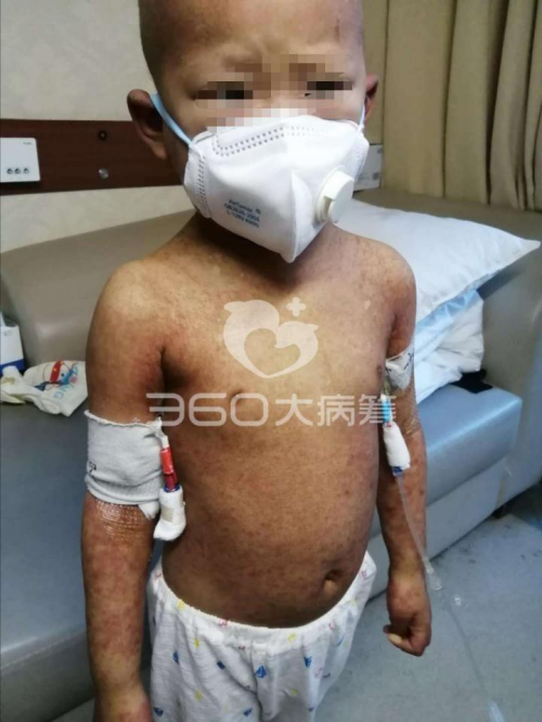 妻兒接連重病心力交瘁 湖南漢子求助360大病籌盼兒康復