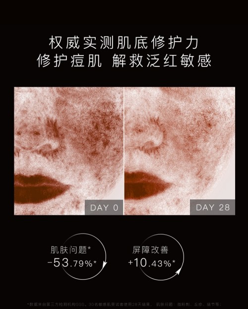挑戰(zhàn)7天強韌修護肌底HomeFacialPro黑標(biāo)系列基底修護精華液震撼上市