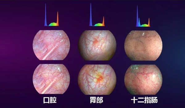 光隨影動 開立醫(yī)療國產內鏡功能領跑智能新方向