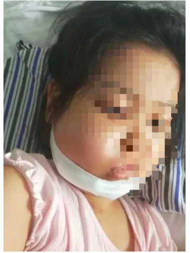 女童3歲確診白血病7歲復發(fā)，百萬治療費無著落，水滴籌款幫孩子圓上學夢