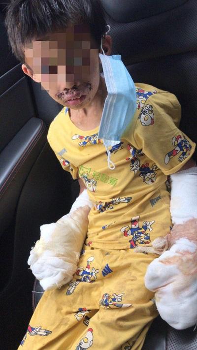愛心大接力！輕松籌上為慘遭生父虐待男孩籌集46萬元善款