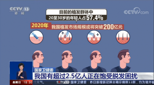 嘉興新生植發(fā)：中國脫發(fā)人群超2.5 億人 3D植發(fā)效果受認可