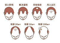 2.5億人被脫發(fā)困擾？Rogaine培健實(shí)力生發(fā)