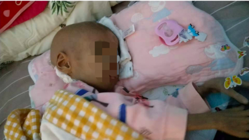 4歲女童得罕見(jiàn)病只有11斤，高昂費(fèi)用壓垮母親，水滴愛(ài)心接力帶來(lái)希望