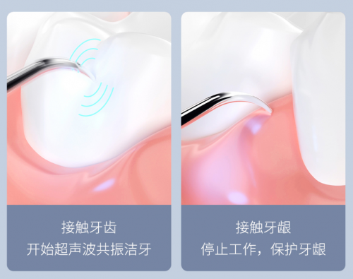 年輕人愛(ài)美從牙齒開(kāi)始，這款199的口腔護(hù)理神器太值了，買(mǎi)它！