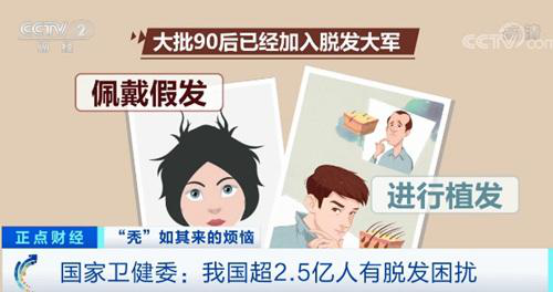 杭州新生植發(fā)：大批90后脫發(fā)，多數(shù)人進(jìn)行3D植發(fā)