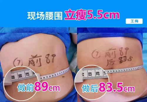 破6.7億！秀域“夏日捉腰季”抖音活動席卷多地，智能纖體項(xiàng)目有口皆碑