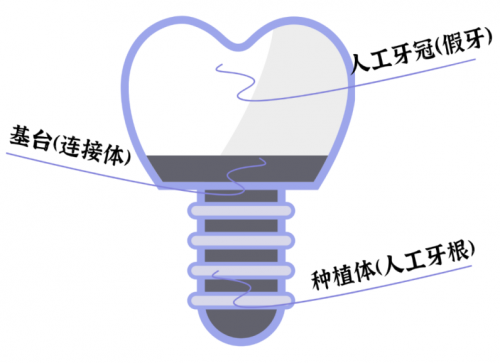 缺一兩顆牙沒關(guān)系，這屆年輕人的想法真的很危險(xiǎn)