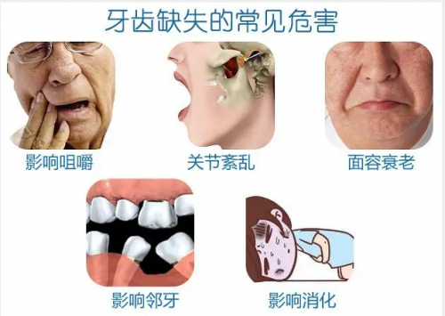 缺一兩顆牙沒關(guān)系，這屆年輕人的想法真的很危險(xiǎn)