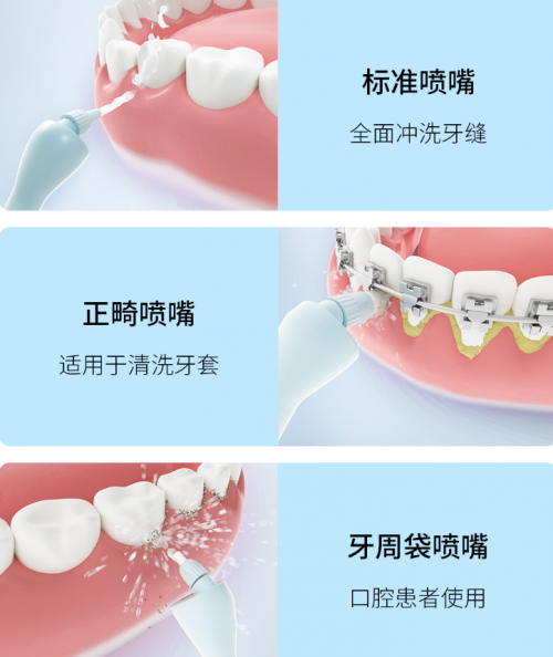 正畸人士福音！素諾智能可視沖牙器C3 pro看得清，沖得凈