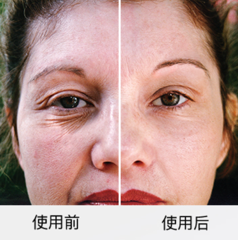 DermaWand Pro逆齡射頻活氧棒在家里也能享受到的輕醫(yī)美