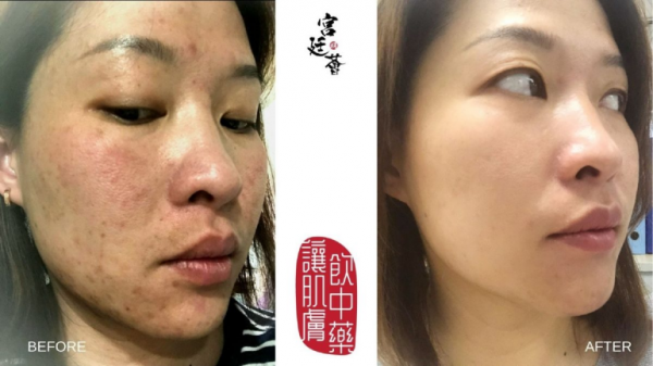 Myeong香港宮廷薈，帶你解鎖宮廷中藥新護(hù)膚方式！