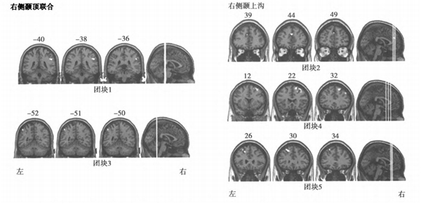 金博智慧褚明禮：孩子有注意缺陷、多動障礙，家長需警惕孤獨癥影響