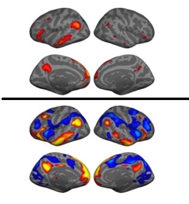 金博智慧褚明禮：經(jīng)顱直流電刺激（tDCS）改善孤獨癥兒童社交、認知的腦科學(xué)證據(jù)