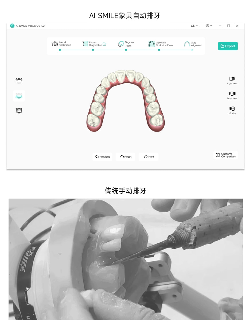 獨角獸地位盡顯！象貝AI正畸排牙系統(tǒng)Venus1.0發(fā)布 開辟數(shù)字化牙科新紀(jì)元
