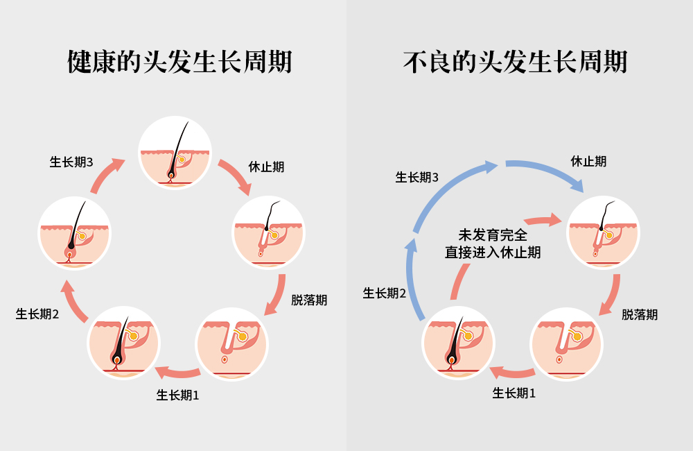 拯救頭頂大事，采用創(chuàng)新配方REDENICAL的DR ZERO來到中國