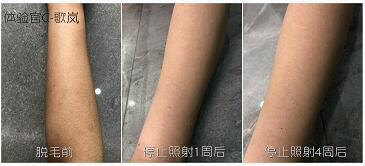 這3款網(wǎng)紅脫毛儀評(píng)測(cè)大集錦，你都了解過(guò)了嗎？