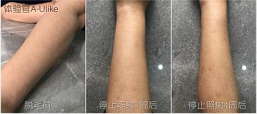這3款網(wǎng)紅脫毛儀評(píng)測(cè)大集錦，你都了解過(guò)了嗎？