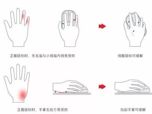 當(dāng)鼠標(biāo)“垂直”，會發(fā)生什么？多彩垂直鼠標(biāo)體驗