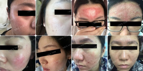 美內(nèi)“小奶泡”，最簡單的潔面產(chǎn)品你選對了嗎？