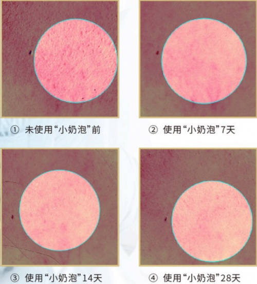 美內(nèi)“小奶泡”，最簡單的潔面產(chǎn)品你選對了嗎？