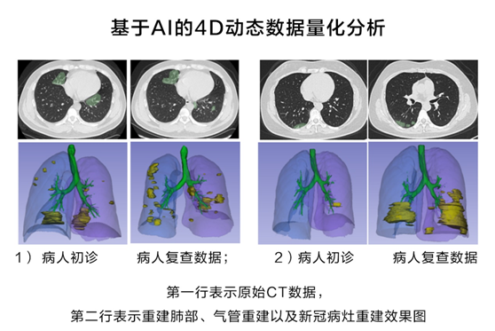 華為云推出新冠肺炎AI輔助診斷服務(wù)，疫情期間免費(fèi)對定點(diǎn)收治醫(yī)院開放