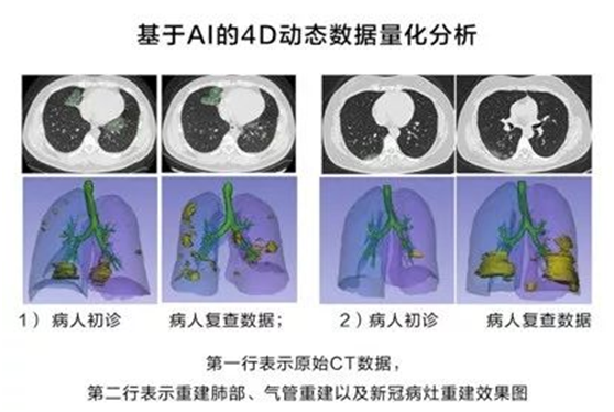 非常時(shí)期下的城市防控、生產(chǎn)與治理，華為云用AI“全鏈條“戰(zhàn)疫