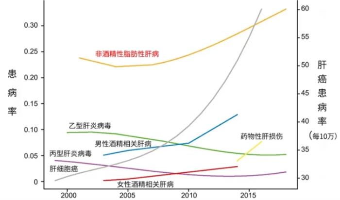 中國非酒精性脂肪肝泛濫，西班牙plameca波利王益肝露拯救代謝危機